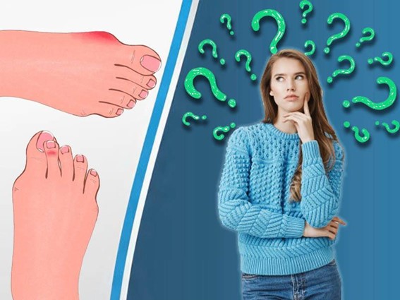 What are the causes of corns on the feet?