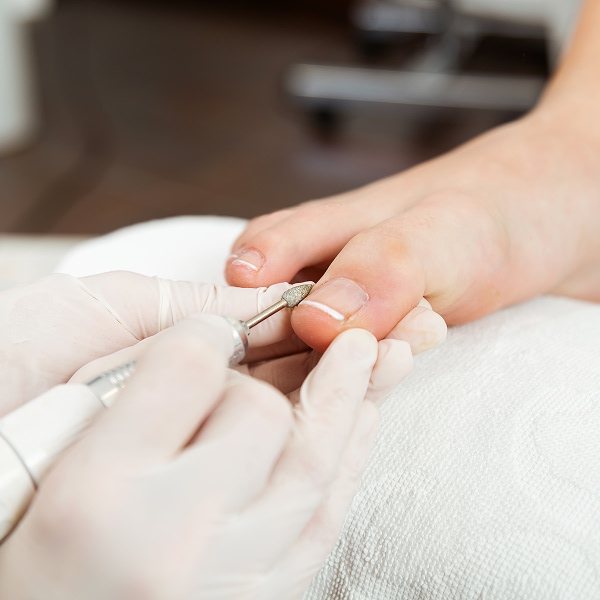 Podiatrist performing professional toenail treatment at Clinique Podiatrique de Laval