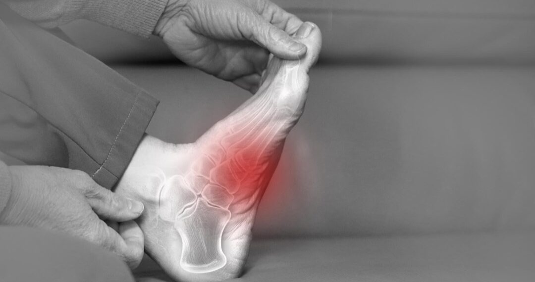 Douleur et complications de l’arthrose du pied avec prévention et solutions proposées par une clinique podiatrique à Laval