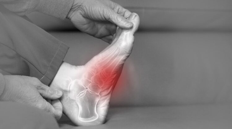 Douleur et complications de l&rsquo;arthrose du pied avec pr&eacute;vention et solutions propos&eacute;es par une clinique podiatrique &agrave; Laval