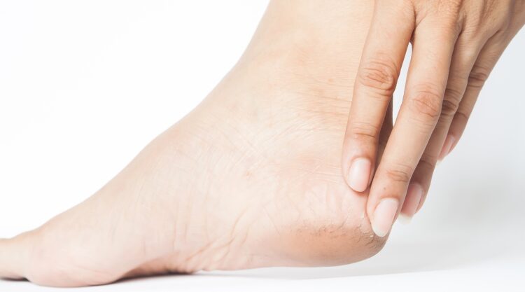 pieds-secs-comprendre-causes-solutions